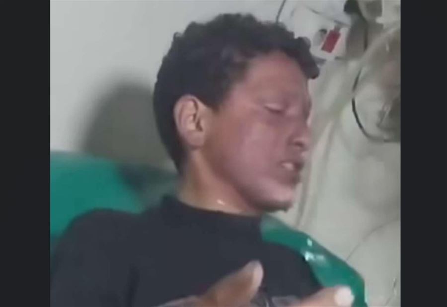 جريمة مروّعة في هذه المنطقة اللبنانية.. شاب يشعل النار بقاصر...