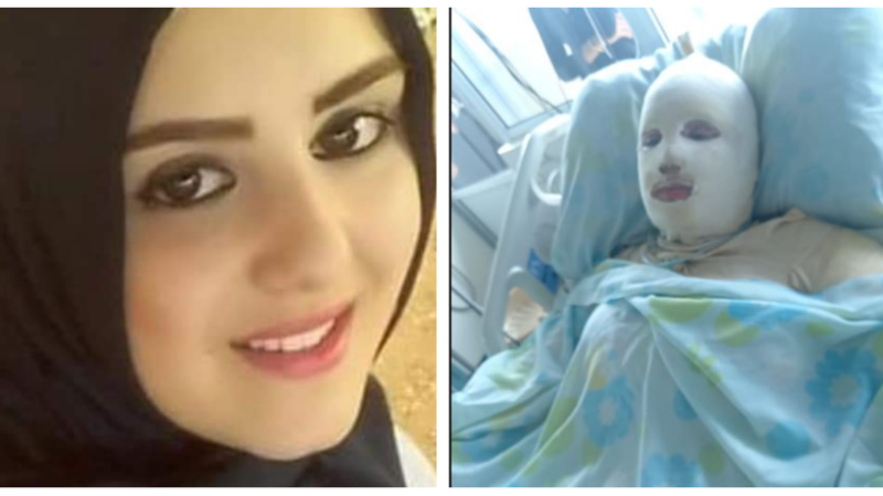 العنف الأسري يلاحق نساء لبنان.. مآس ضرب وحرق وتهديد بالذبح