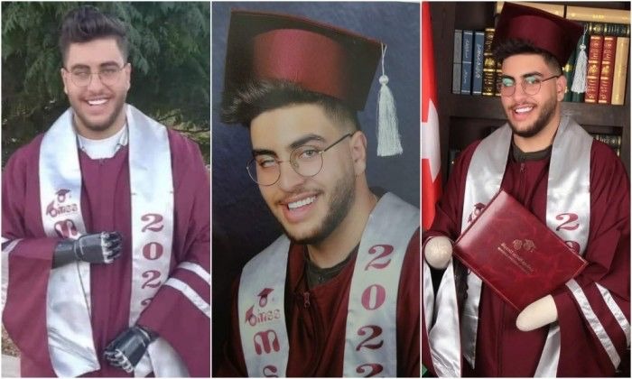 بعد الجريمة التي هزّت الوطن العربي ببتر يديه وفَقْء عينه.. 'فتى الزرقاء' يتغلّب على محنته ويتفوّق في الثانوية العامة