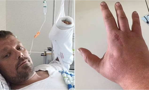 عضة قطة تنهي حياة شاب بعد 4 سنوات من تعرضه للحادثة