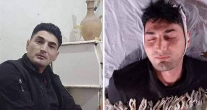 شاب يعود إلى الحياة أثناء دفنه بعد الزلزال في سوريا